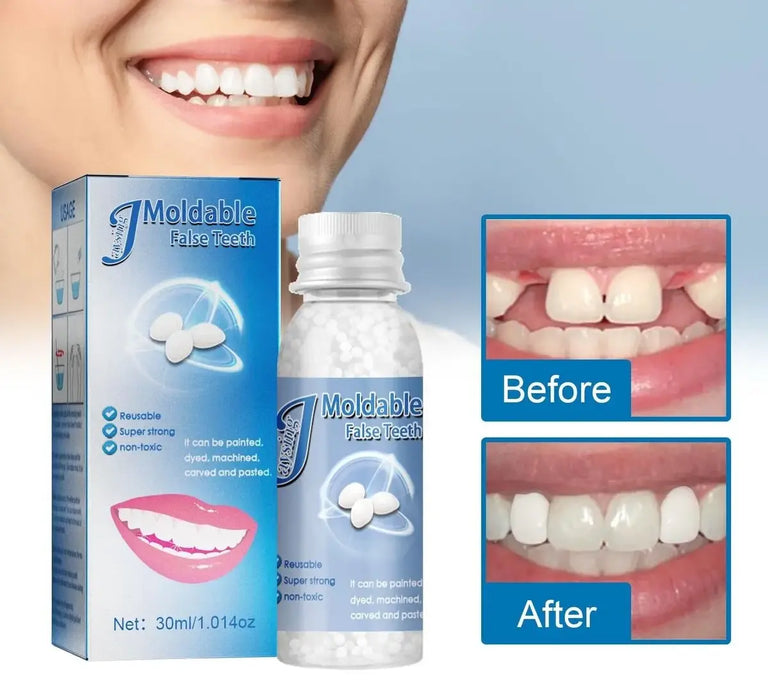 Resina Dental Moldeable: Sonríe Sin Miedo 😁
