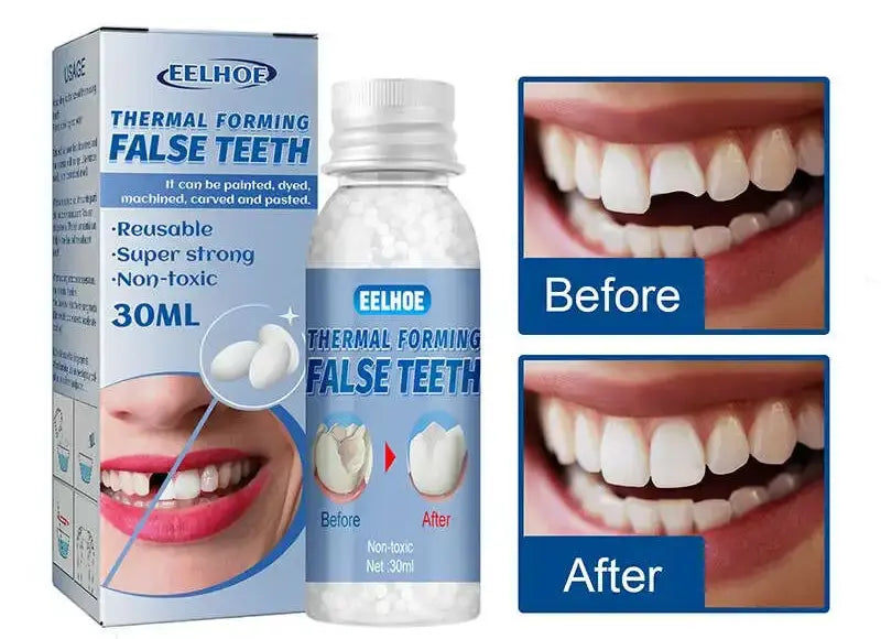 Resina Dental Moldeable: Sonríe Sin Miedo 😁